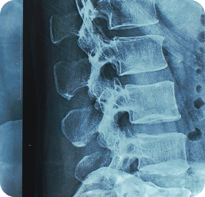 cibio-catalogue_0004_cibio-Osteodensitometrie