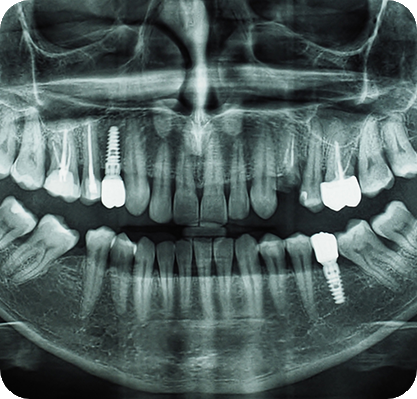 cibio-catalogue_0005_cibio-radiographie-dentaire-(1)